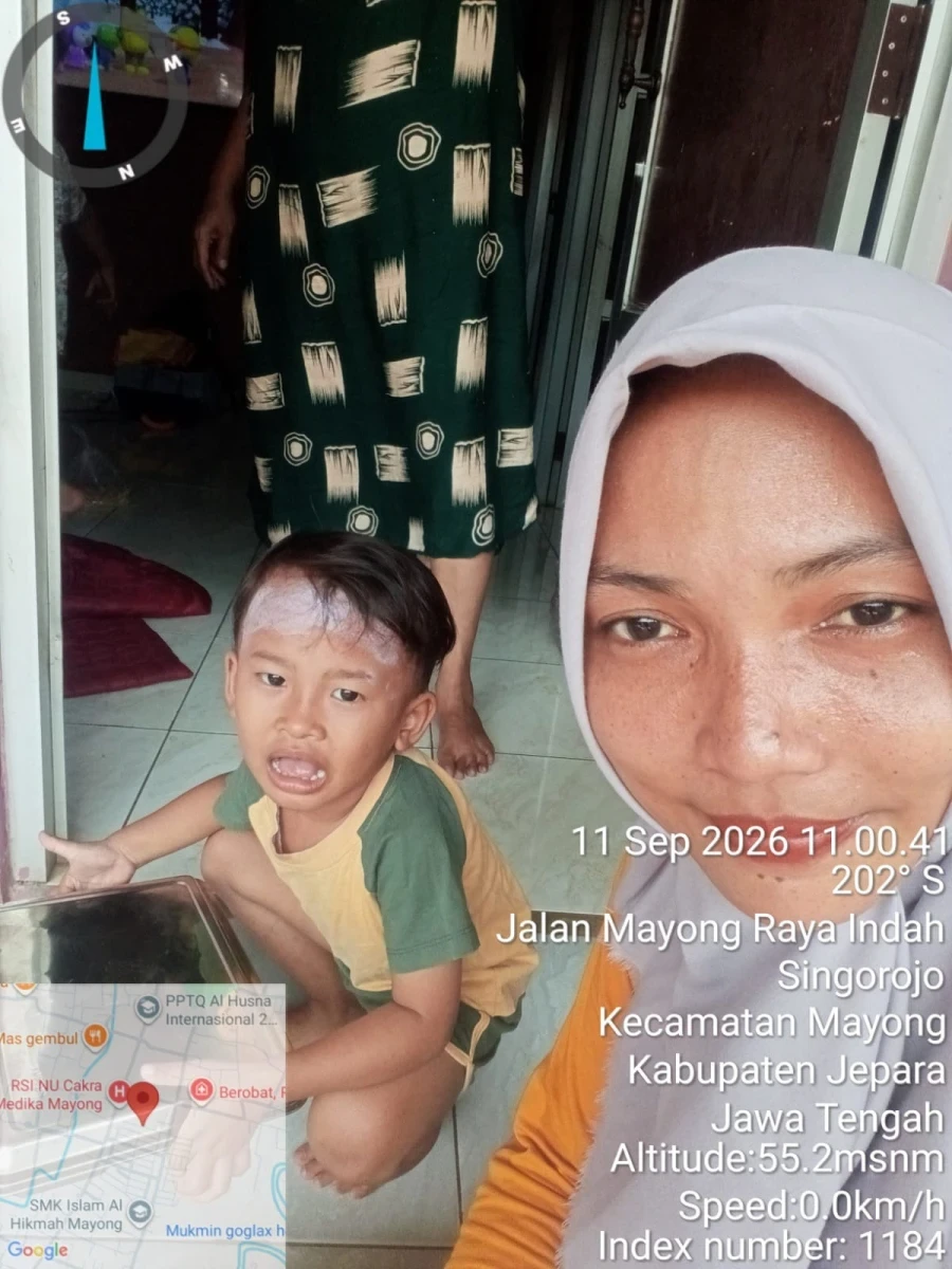 Penyaluran Program MBG Balita di Lingkungan Posyandu Anggrek 1 Desa Singorojo