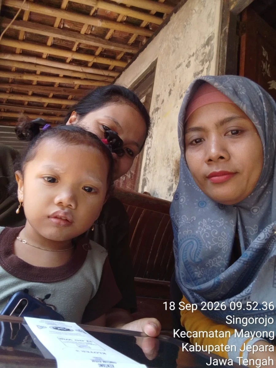 Kerap Khawatir Soal Gizi, Busui Singorojo Merasa Terbantu Program MBG Posyandu Dahlia